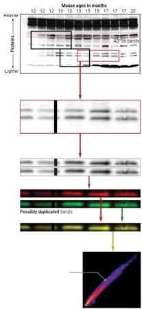 amyloid beta