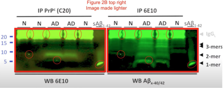 amyloid beta