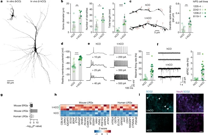 Maturation and circuit integration of transplanted human cortical organoids