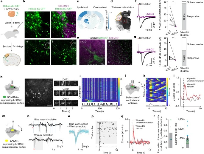 Maturation and circuit integration of transplanted human cortical organoids