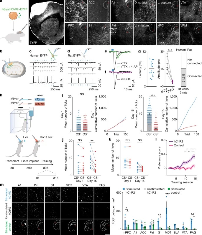 Maturation and circuit integration of transplanted human cortical organoids