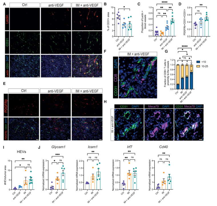 Cancer cell autophagy, reprogrammed macrophages, and remodeled vasculature in glioblastoma triggers tumor immunity