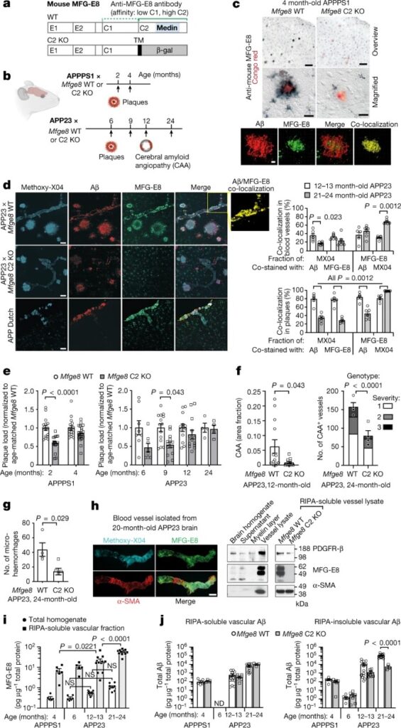 Medin co-aggregates with vascular amyloid-β in Alzheimer’s disease