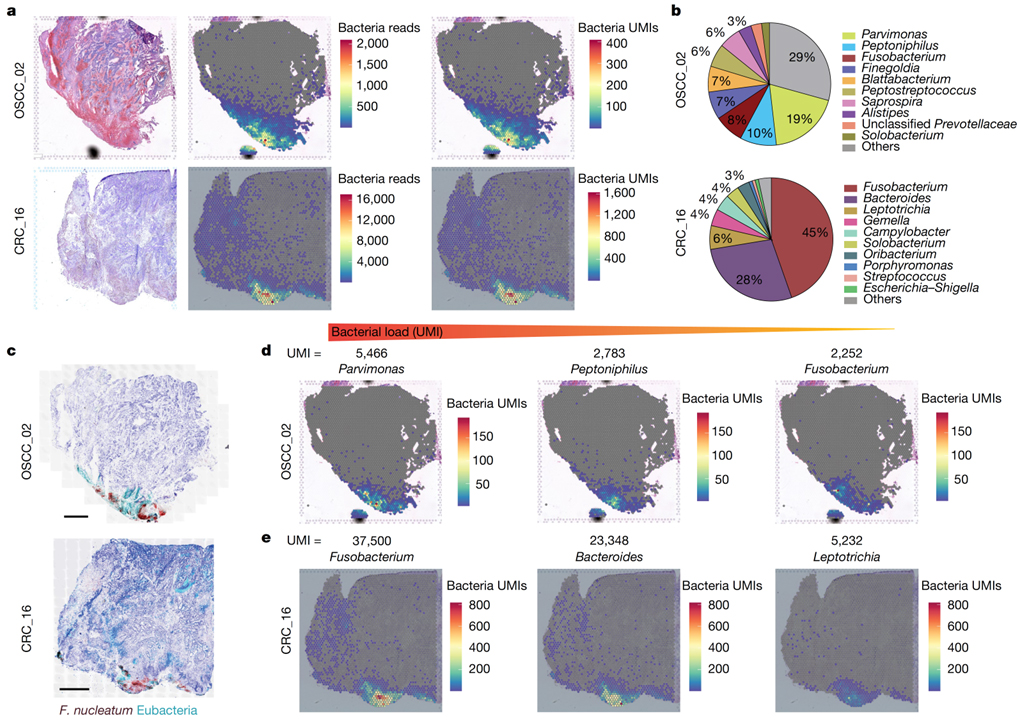 Effect of the intratumoral microbiota on spatial and cellular heterogeneity in cancer