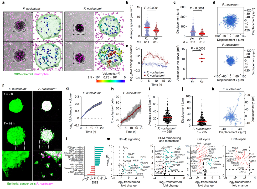 Effect of the intratumoral microbiota on spatial and cellular heterogeneity in cancer