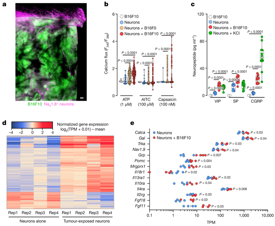 Nociceptor neurons affect cancer immunosurveillance