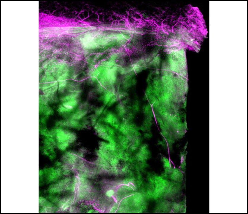 Nociceptor neurons affect cancer immunosurveillance