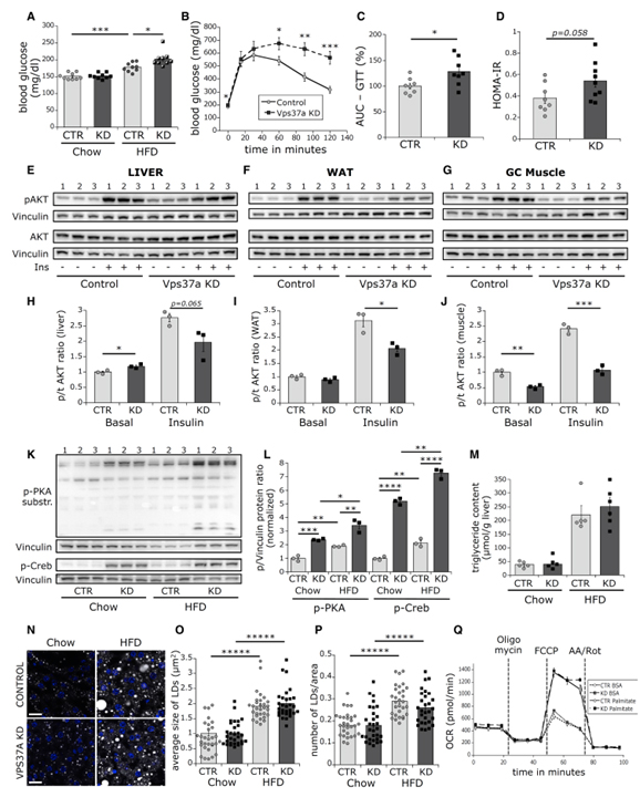 Vps37a regulates hepatic glucose production by controlling glucagon receptor localization to endosomes