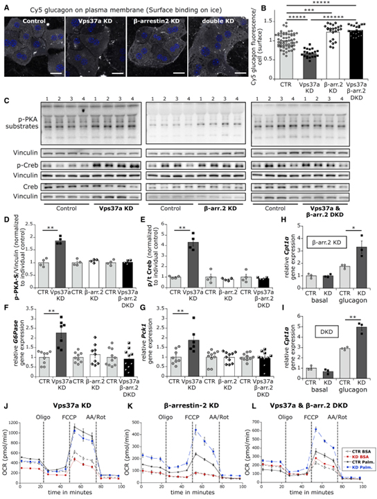 Vps37a regulates hepatic glucose production by controlling glucagon receptor localization to endosomes