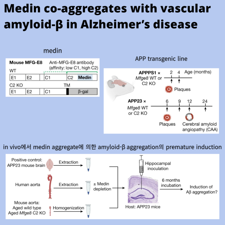 Medin co-aggregates with vascular amyloid-β in Alzheimer’s disease