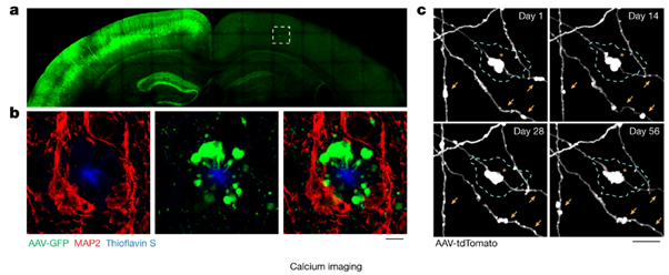 [Abs] PLD3 affects axonal spheroids and network defects in Alzheimer's disease