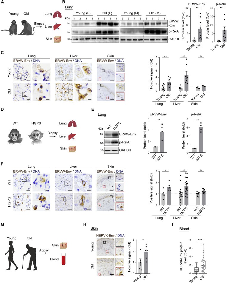 Resurrection of endogenous retroviruses during aging reinforces senescence