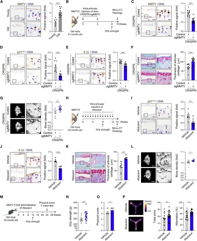 Resurrection of endogenous retroviruses during aging reinforces senescence