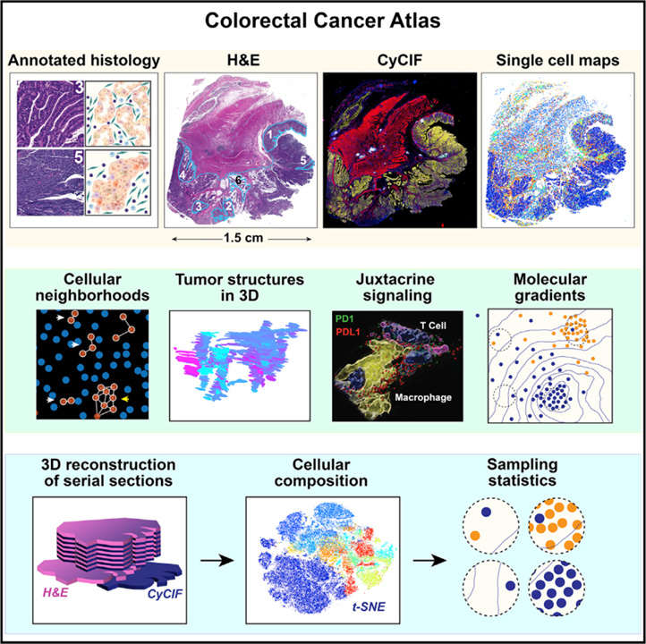 Multiplexed 3D atlas of state transitions and immune interaction in colorectal cancer