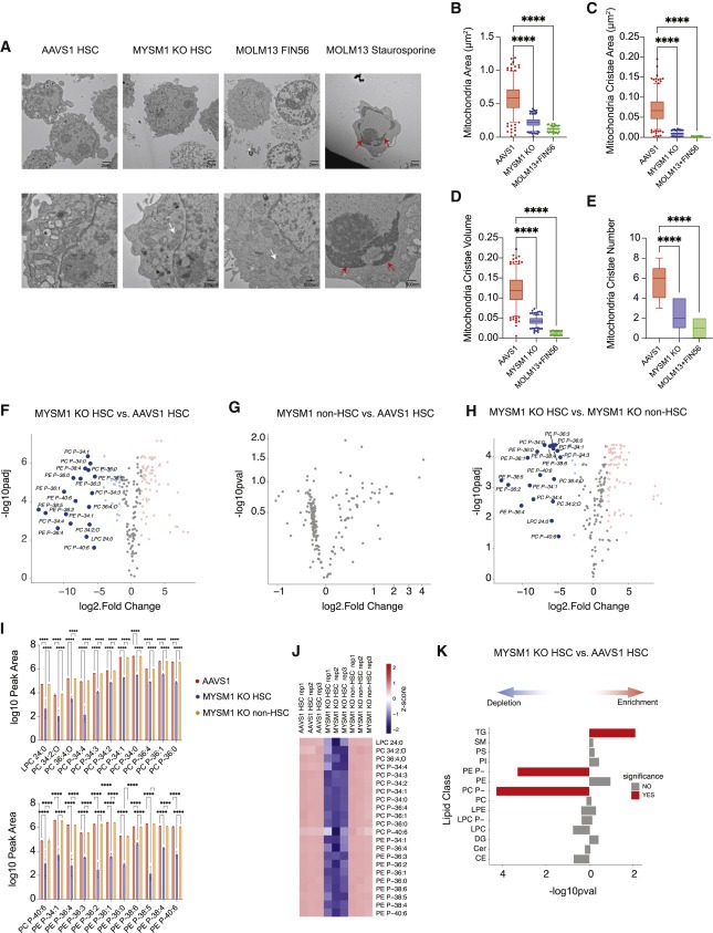 Human hematopoietic stem cell vulnerability to ferroptosis