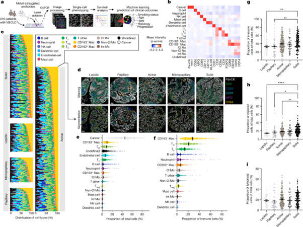 [Fig1] Single-cell spatial landscapes of the lung tumour immune microenvironment