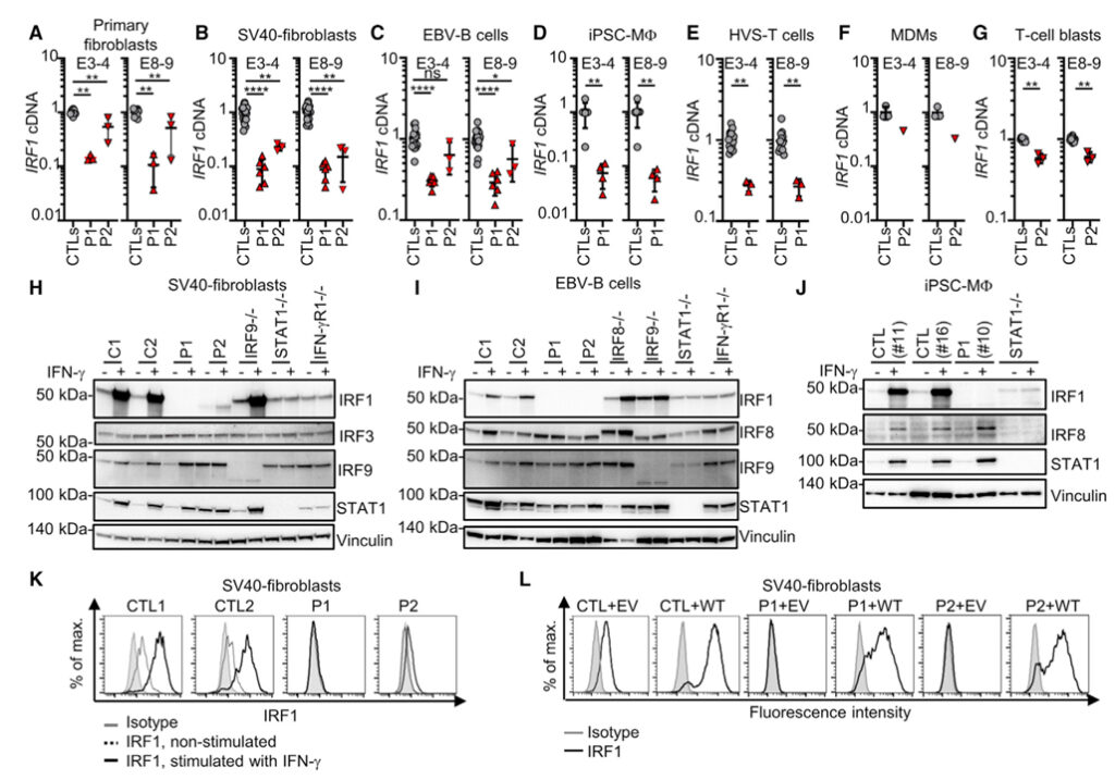 Human IRF1 governs macrophagic IFN-γ immunity to mycobacteria