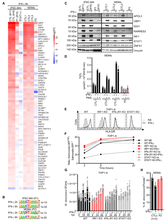 Human IRF1 governs macrophagic IFN-γ immunity to mycobacteria