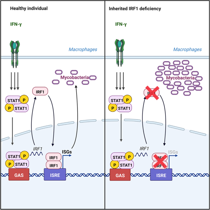 Human IRF1 governs macrophagic IFN-γ immunity to mycobacteria