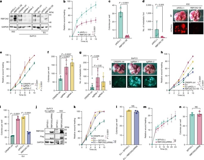 RBFOX2 modulates a metastatic signature of alternative splicing in pancreatic cancer