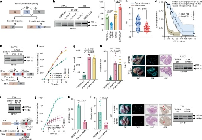 RBFOX2 modulates a metastatic signature of alternative splicing in pancreatic cancer