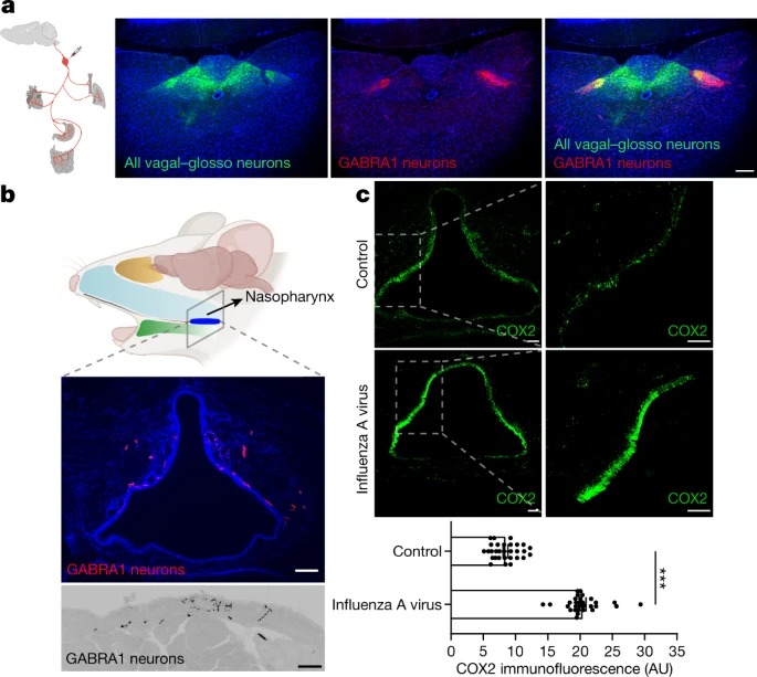 An airway-to-brain sensory pathway mediates influenza-induced sickness