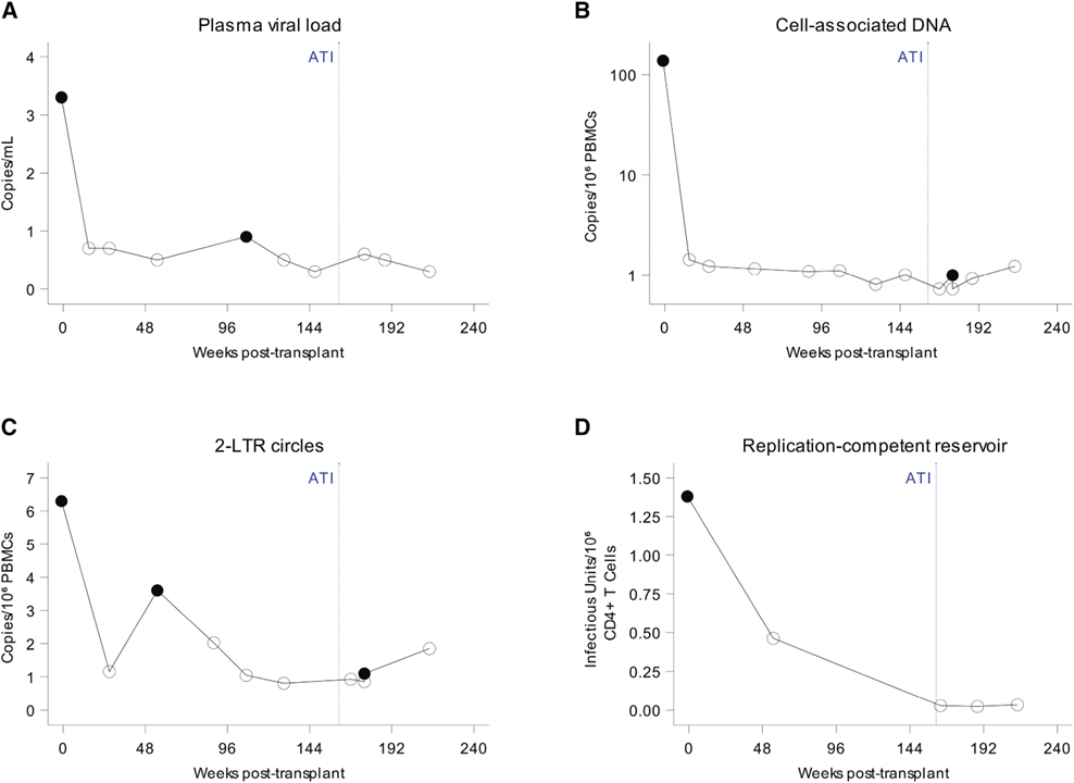 HIV-1 remission and possible cure in a woman after haplo-cord blood transplant