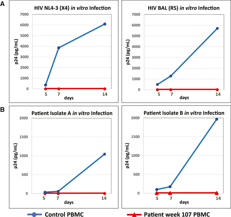 HIV-1 remission and possible cure in a woman after haplo-cord blood transplant