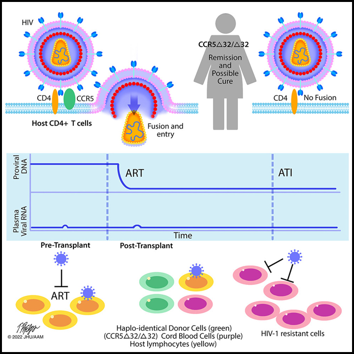 Read more about the article HIV-1 remission and possible cure in a woman after haplo-cord blood transplant