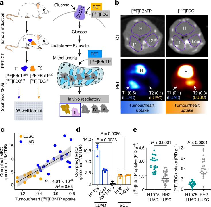 Spatial mapping of mitochondrial networks and bioenergetics in lung cancer