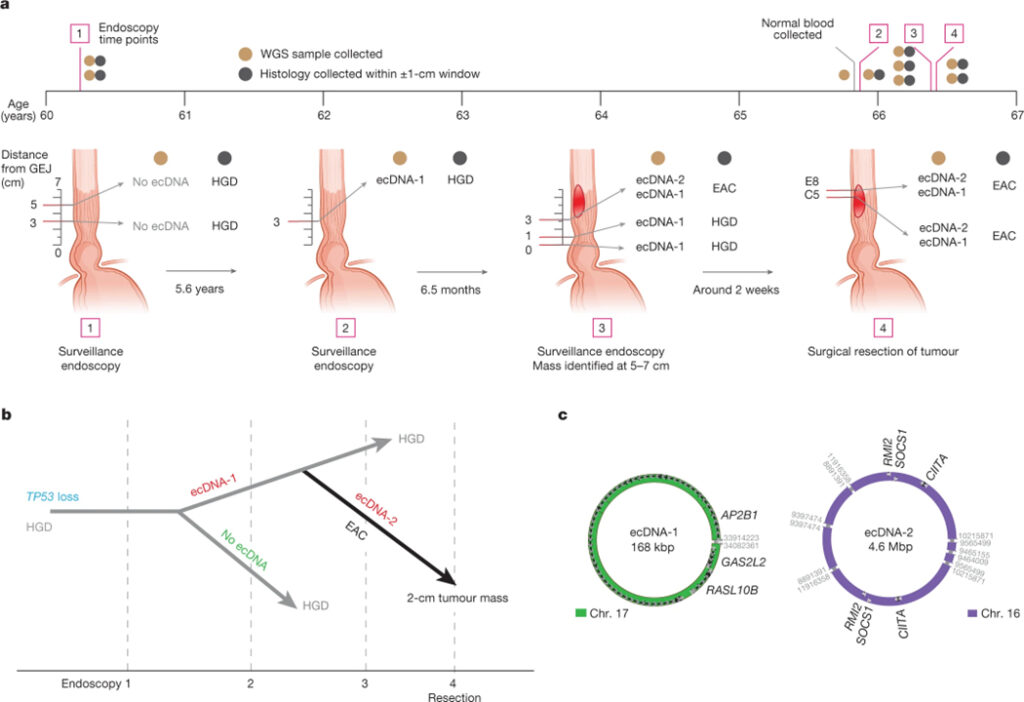 Extrachromosomal DNA in the cancerous transformation of Barrett’s oesophagus