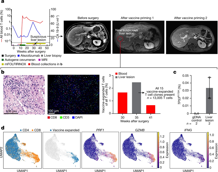 Personalized RNA neoantigen vaccines stimulate T cells in pancreatic cancer