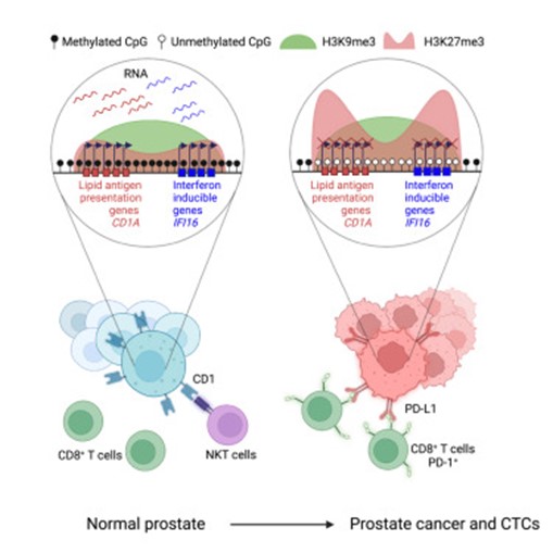 [Abs] DNA hypomethylation silences anti-tumor immune genes in early prostate cancer and CTCs