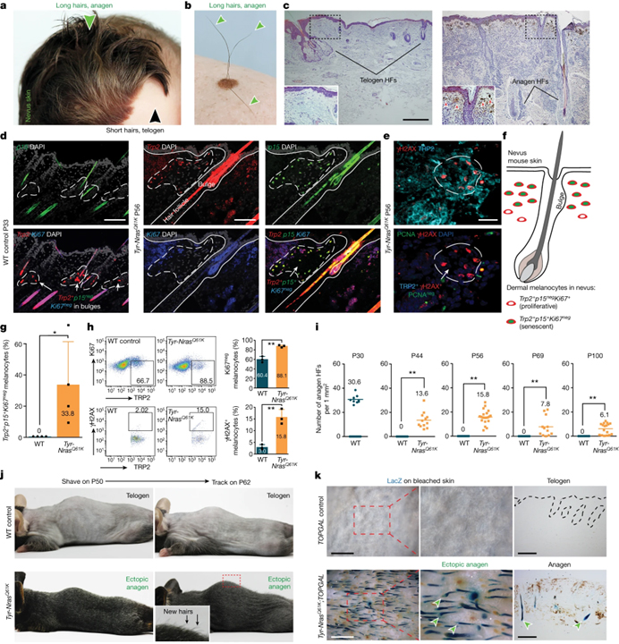 Signalling by senescent melanocytes hyperactivates hair growth