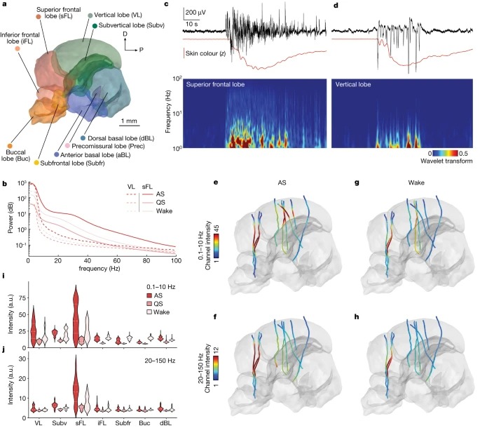 Wake-like skin patterning and neural activity during octopus sleep