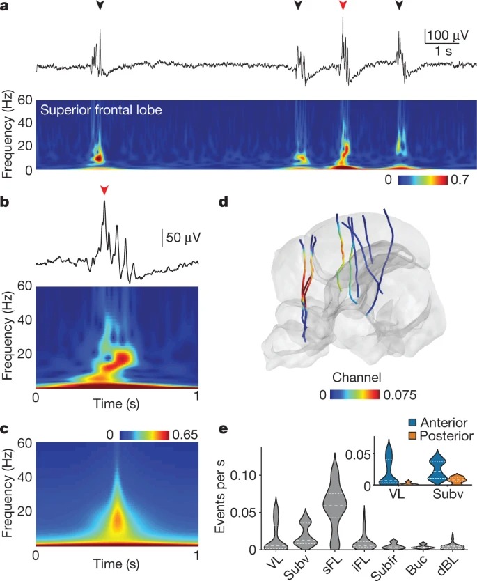 Wake-like skin patterning and neural activity during octopus sleep