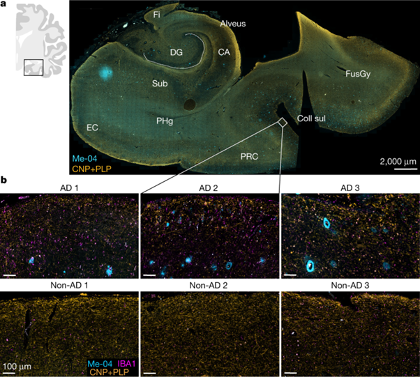 [Abs] Myelin dysfunction drives amyloid-β deposition in models of Alzheimer’s disease