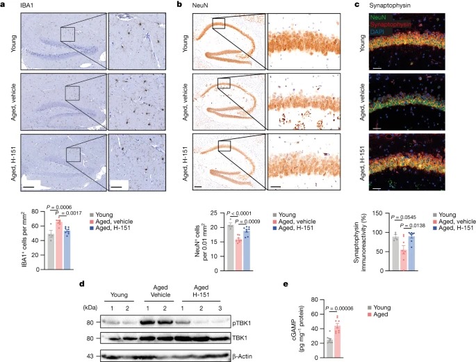 cGAS–STING drives ageing-related inflammation and neurodegeneration