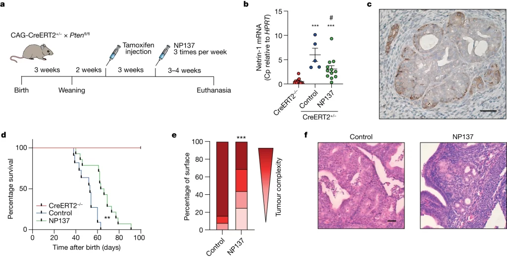 Tamoxifen-induced endometrial cancer mouse model