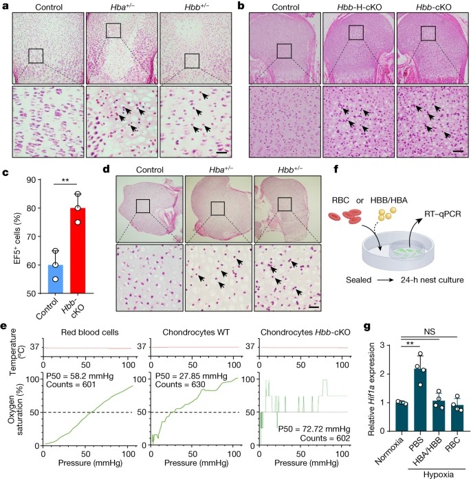 An extra-erythrocyte role of haemoglobin body in chondrocyte hypoxia adaption