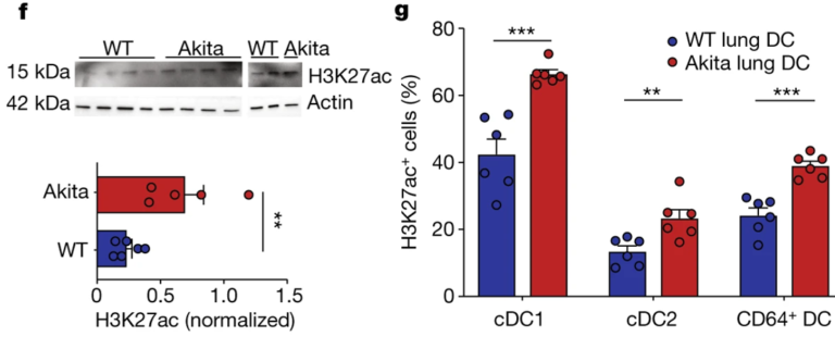 Fig. 4: Hyperglycaemia dysregulates lung DC metabolism and acetylation.