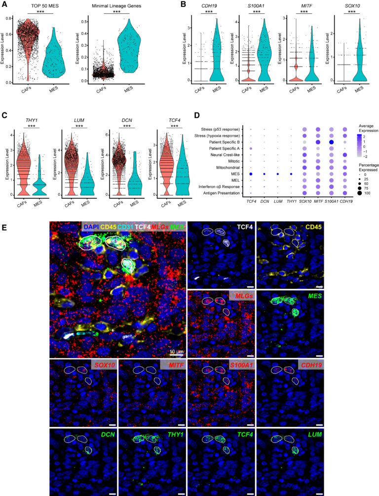 Fig 3: melanoma MES 세포의 식별 및 현장 매핑