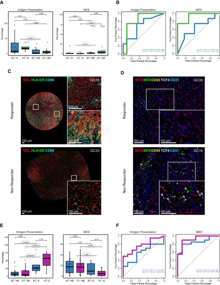 Fig 4: melanoma MES 상태는 ICB에 대한 반응과 관련이 있음