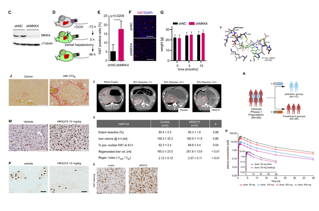 First-in-class MKK4 inhibitors enhance liver regeneration and prevent liver failure