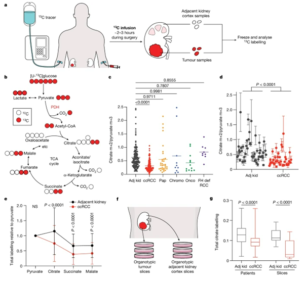 [Fig1] Mitochondrial complex I promotes kidney cancer metastatis