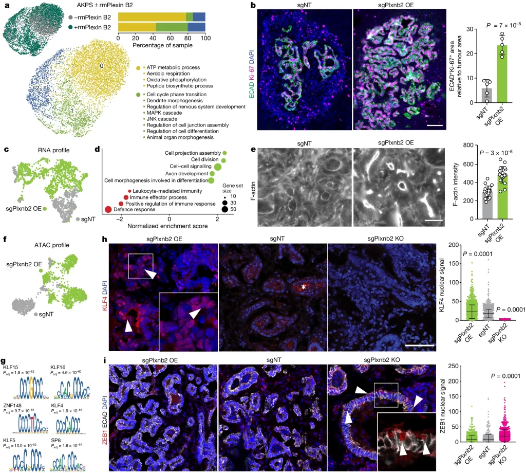 Fig. 3: Plexin B2 induces epithelialization of liver metastases.